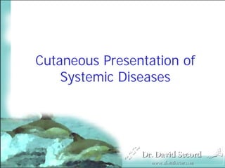 Cutaneous Presentation of
    Systemic Diseases
 