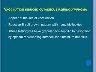 VACCINATION INDUCED CUTANEOUS PSEUDOLYMPHOMA
 Appear at the site of vaccination
 Reactive B-cell growth pattern with many histiocytes
 These histiocytes have granular eosinophilic to basophilic
cytoplasm representing intracellular aluminium deposits.
 