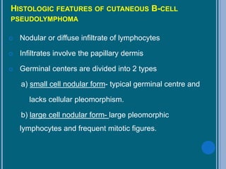 HISTOLOGIC FEATURES OF CUTANEOUS B-CELL
PSEUDOLYMPHOMA
 Nodular or diffuse infiltrate of lymphocytes
 Infiltrates involve the papillary dermis
 Germinal centers are divided into 2 types
a) small cell nodular form- typical germinal centre and
lacks cellular pleomorphism.
b) large cell nodular form- large pleomorphic
lymphocytes and frequent mitotic figures.
 