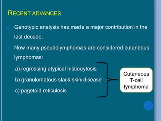 RECENT ADVANCES
 Genotypic analysis has made a major contribution in the
last decade.
 Now many pseudolymphomas are considered cutaneous
lymphomas:
a) regressing atypical histiocytosis
b) granulomatous slack skin disease
c) pagetoid reticulosis
Cutaneous
T-cell
lymphoma
 