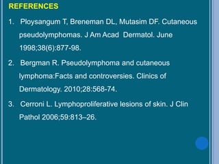 REFERENCES
1. Ploysangum T, Breneman DL, Mutasim DF. Cutaneous
pseudolymphomas. J Am Acad Dermatol. June
1998;38(6):877-98.
2. Bergman R. Pseudolymphoma and cutaneous
lymphoma:Facts and controversies. Clinics of
Dermatology. 2010;28:568-74.
3. Cerroni L. Lymphoproliferative lesions of skin. J Clin
Pathol 2006;59:813–26.
 