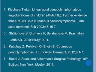 4. Kiyohara T et.al. Linear acral pseudolymphomatous
angiokeratoma of children (APACHE): Further evidence
that APACHE is a cutaneous pseudolymphoma. J am
acad dermatol. Feb 2003;48:15-7.
5. Shtilionova S, Drumeva P, Balabanova M, Krasnaliev.
JofIMAB. 2010;16(3):100-1.
6. Kutlubay Z, Pehlivan O, Engin B. Cutaneous
peudolymphomas. J Turk Acad Dermatol. 2012;6:1-7.
7 Rosai J. Rosai and Ackerman’s Surgical Pathology. 10th
Edition. New York: Mosby; 2011.
 