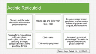 Actinic Reticuloid
Chronic multifactorial
dermatitis with severe
photosensitivity
Middle age and older men
Face, neck
In sun exposed areas:
persistent erythematous
lichenoid papules and
plaques, facies leonina
Psoriasiform hyperplasia,
mild spongiosis,
eosinophils, coarsed and
vertically arranged
collagen bundles in the
papillary dermis
CD8 + cells
TCR mostly polyclonal
Increased number of
circulating CD8+ cells in
the peripheral blood,
photosensitivity
Semin Diagn Pathol 1991 (8)109–16.
 