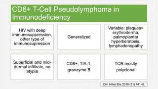 CD8+ T-Cell Pseudolymphoma in
Immunodeficiency
HIV with deep
immunosuppression,
other type of
immunosupression
Generalized
Variable: plaques>
erythroderma,
palmoplantar
hyperkeratosis,
lymphadenopathy
Superficial and mid-
dermal infiltrate, no
atypia
CD8+, TIA-1,
granzyme B
TCR mostly
polyclonal
Clin Infect Dis 2010 (51) 741–8.
 