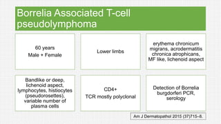 Borrelia Associated T-cell
pseudolymphoma
60 years
Male + Female
Lower limbs
erythema chronicum
migrans, acrodermatitis
chronica atrophicans,
MF like, lichenoid aspect
Bandlike or deep,
lichenoid aspect,
lymphocytes, histiocytes
(pseudorosettes),
variable number of
plasma cells
CD4+
TCR mostly polyclonal
Detection of Borrelia
burgdorferi PCR,
serology
Am J Dermatopathol 2015 (37)715–8.
 