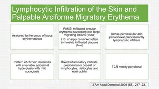 Lymphocytic Infiltration of the Skin and
Palpable Arciforme Migratory Erythema
Assigned to the group of lupus
erythematosus
PAME: Infiltrated annular
erythema developing into large
migrating lesions (trunk)
LIS: sharply demarked often
symmetric infiltrated plaques
(face)
Dense perivascular and
periadnexal predominantly
lymphocytic infiltrate
Pattern of chronic dermatitis
with a variable epidermal
hyperplasia with mild
spongiosis
Mixed inflammatory infiltrate,
predominately consist of
lymphocytes, histiocytes and
eosinophils
TCR mostly polyclonal
J Am Acad Dermatol 2008 (58), 217–23.
 