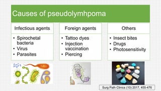 Causes of pseudolymhpoma
Infectious agents
• Spirochetal
bacteria
• Virus
• Parasites
Foreign agents
• Tattoo dyes
• Injection
vaccination
• Piercing
Others
• Insect bites
• Drugs
• Photosensitivity
Surg Path Clinics (10) 2017, 455-476
 