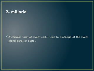 2- miliaria
A common form of sweat rash is due to blockage of the sweat
gland pores or ducts .
 