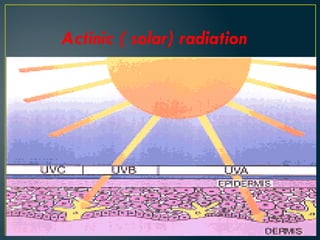 Actinic ( solar) radiation
 