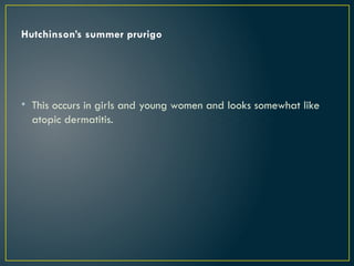 Hutchinson’s summer prurigo
• This occurs in girls and young women and looks somewhat like
atopic dermatitis.
 