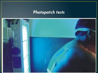 Photopatch tests
 