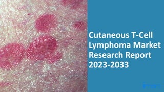 Cutaneous T-Cell
Lymphoma Market
Research Report
2023-2033
 