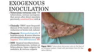 Tuberculosis verrucosa cutis- TBVC, also known as prosector's wart, anatomic
tuberculosis, verruca necrogenica, & warty tuberculosis) is a form of cutaneous TB
that occurs after direct inoculation of the mycobacteria into the skin of a
previously sensitized host with moderate to high immunity against the bacillus.
 Clinically- TBVC most frequently develops on the acral extremities; the fingers &
dorsum of the hands are commonly affected. Solitary lesions, manifest as painless,
violaceous or brown-red, indurated warty plaques, ulceration is uncommon.
 Diagnosis- Histopathologically, Pseudoepitheliomatous hyperplasia, marked
hyperkeratosis, & micro abscesses in the superficial dermis or the
pseudoepitheliomatous rete pegs; Cultures taken from lesions of TBVC are often
negative; Few AFB detected; TST Strongly +ve
 DDX- Atypical mycobacterioses, blastomycosis, Majocchi's granuloma,
chromoblastomycosis, tertiary syphilis, verrucous epidermal nevus, hypertrophic
lichen planus, lupus vulgaris, halogenoderma, benign keratoses, prurigo
nodularis, & verruca vulgaris
 