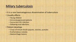 Miliary tuberculosis
• It is a rare haematogenous dissemination of tuberculosis
• Usually affects
– Young children
– Immunosuppressed patients
– Concurrent HIV infection
– Following viral infections
• Patient develops
– Crops of minute bluish papules, vesicles, pustules
– Erythematous nodules
– Haemorrhagic lesions
 