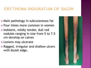 Cutaneous tuberculosis final ppt | PPTX