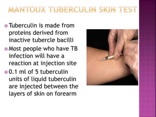 Tubercolin Cutaneous tuberculosis final ppt | PPTX