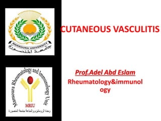 Prof.Adel Abd Eslam
Rheumatology&immunol
ogy
CUTANEOUS VASCULITIS
 