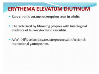 Cutaneous vasculitis