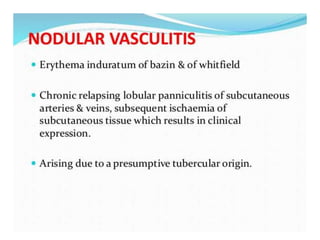 Cutaneous vasculitis