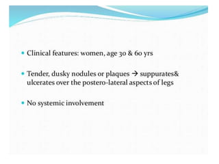 Cutaneous vasculitis