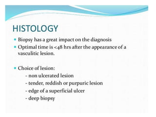 Cutaneous vasculitis
