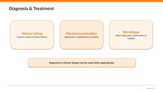 A Study on Cutaneous Warts & Corelation with Barber Hair Cutting Tool