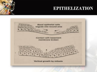 Cutaneous wound healing | PDF | First Aid | Injuries