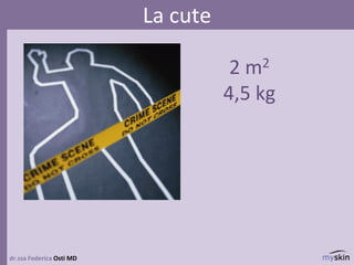2 m2
4,5 kg
dr.ssa Federica Osti MD
La cute
 
