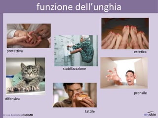 dr.ssa Federica Osti MD
funzione dell’unghia
protettiva estetica
prensile
tattile
difensiva
stabilizzazione
 