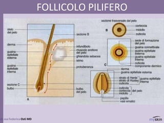 80
dr.ssa Federica Osti MD
FOLLICOLO PILIFERO
 