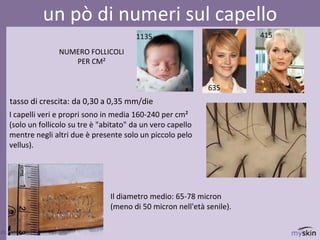 82
dr.ssa Federica Osti MD
un pò di numeri sul capello
Il diametro medio: 65-78 micron
(meno di 50 micron nell'età senile).
NUMERO FOLLICOLI
PER CM²
1135
635
415
I capelli veri e propri sono in media 160-240 per cm²
(solo un follicolo su tre è "abitato" da un vero capello
mentre negli altri due è presente solo un piccolo pelo
vellus).
tasso di crescita: da 0,30 a 0,35 mm/die
 
