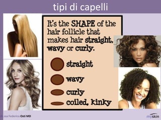 83
dr.ssa Federica Osti MD
tipi di capelli
 