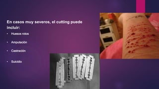 En casos muy severos, el cutting puede
incluir:
• Huesos rotos
• Amputación
• Castración
• Suicidio
 