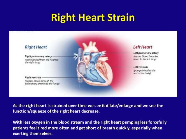 Pulmonary Arterial Hypertension, "The Other High Blood