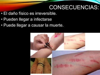 CONSECUENCIAS:
• El daño físico es irreversible.
• Pueden llegar a infectarse
• Puede llegar a causar la muerte.
 