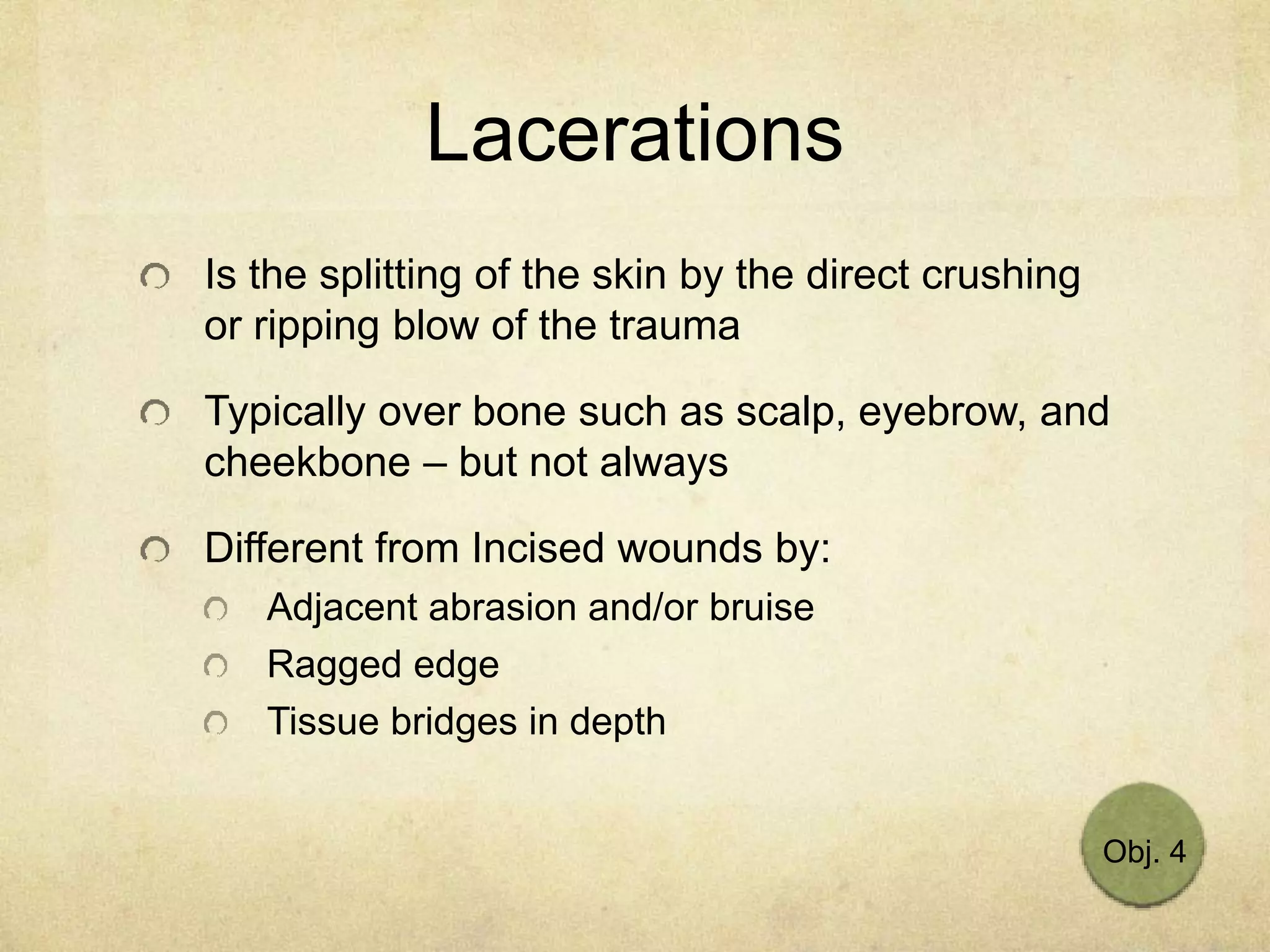 Lacerations
Is the splitting of the skin by the direct crushing
or ripping blow of the trauma
Typically over bone such as scalp, eyebrow, and
cheekbone – but not always
Different from Incised wounds by:
Adjacent abrasion and/or bruise
Ragged edge
Tissue bridges in depth
Obj. 4
 