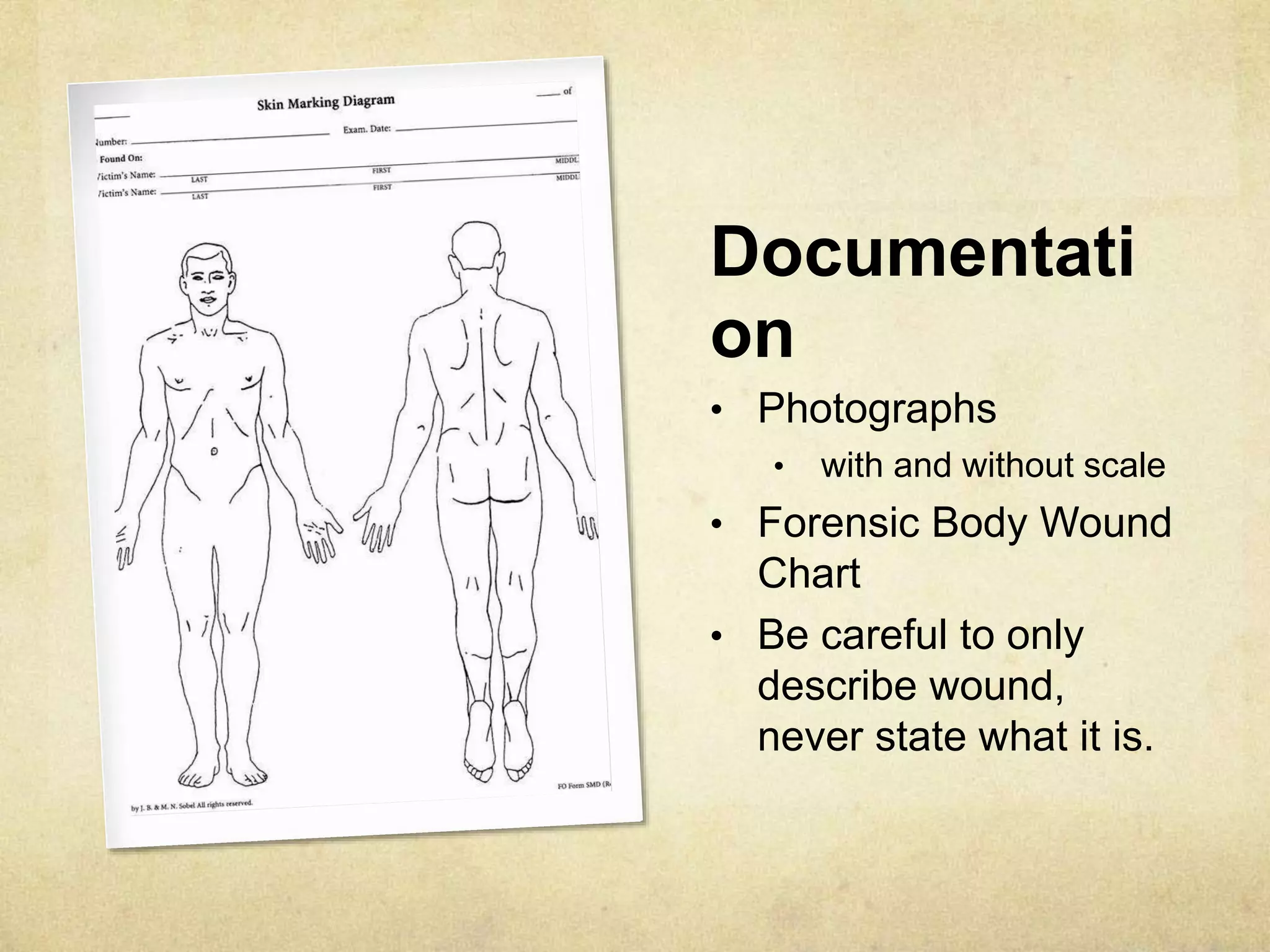 Documentati
on
• Photographs
• with and without scale
• Forensic Body Wound
Chart
• Be careful to only
describe wound,
never state what it is.
 