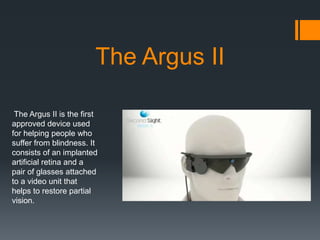 The Argus II
The Argus II is the first
approved device used
for helping people who
suffer from blindness. It
consists of an implanted
artificial retina and a
pair of glasses attached
to a video unit that
helps to restore partial
vision.

 