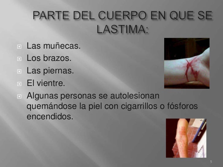 El dolor en la espalda al cáncer matki