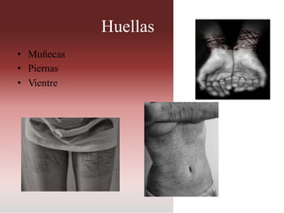 Huellas
• Muñecas
• Piernas
• Vientre
 