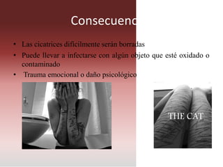 Consecuencias
• Las cicatrices difícilmente serán borradas
• Puede llevar a infectarse con algún objeto que esté oxidado o
contaminado
• Trauma emocional o daño psicológico
 