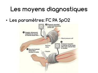 Les moyens diagnostiques
• Les paramètres: FC PA SpO2
 