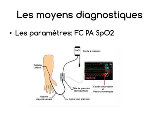 Les moyens diagnostiques
• Les paramètres: FC PA SpO2
 
