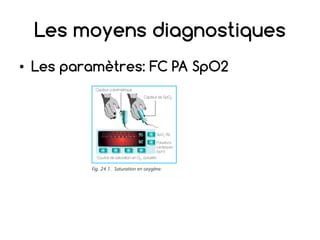 Les moyens diagnostiques
• Les paramètres: FC PA SpO2
 
