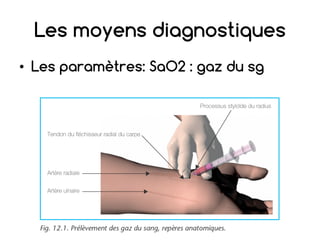 Les moyens diagnostiques
• Les paramètres: SaO2 : gaz du sg
 