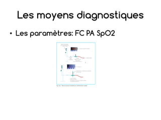 Les moyens diagnostiques
• Les paramètres: FC PA SpO2
 