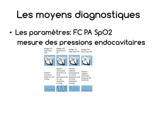 Les moyens diagnostiques
• Les paramètres: FC PA SpO2
mesure des pressions endocavitaires
 