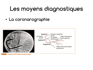 Les moyens diagnostiques
• La coronarographie
 