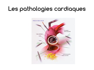 Les pathologies cardiaques
 