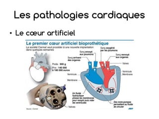 Les pathologies cardiaques
• Le cœur artificiel
 